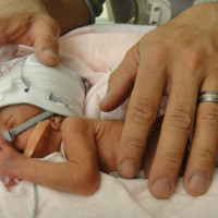 I neonati prematuri sono più sensibili al dolore.